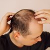 Hair Growth